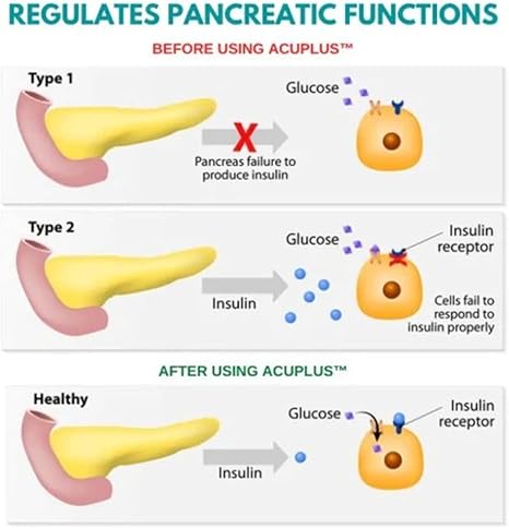 Sugar Acupressure LI-4 Magnetic Clip