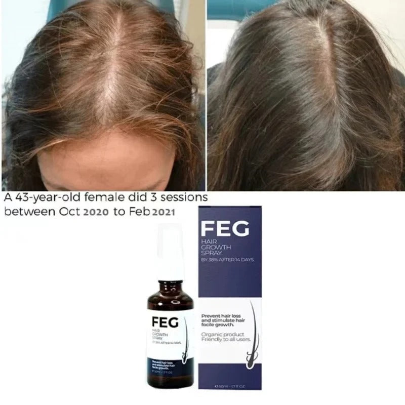 FEG Plus Hair Growth Spray – Stimulates Follicles & Reduces Hair Fall