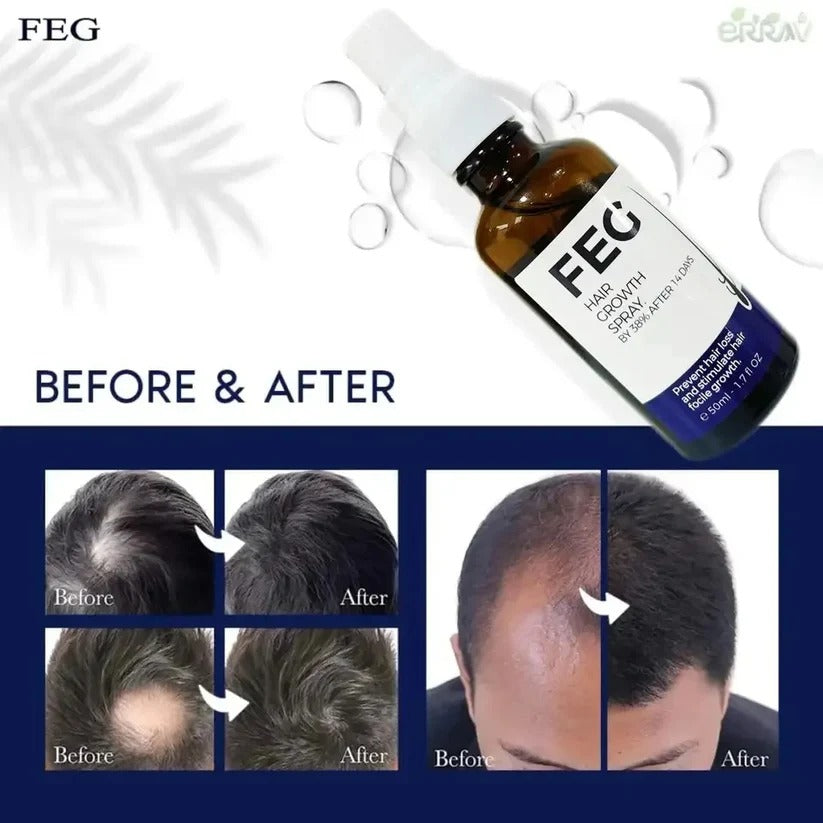 FEG Plus Hair Growth Spray – Stimulates Follicles & Reduces Hair Fall